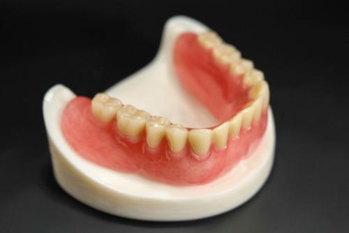 单颗牙缺失怎么修复？