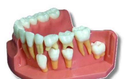 牙颌畸形与矫正