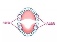 六龄齿保护很重要