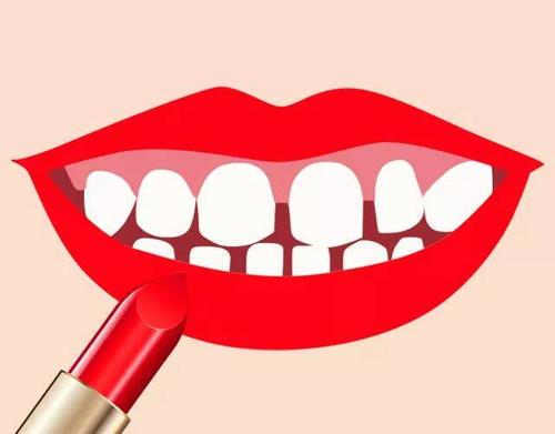 牙齿需要矫正的8种情况