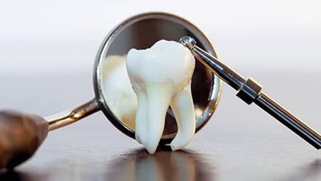 常见补牙材料有哪些？该如何选择？