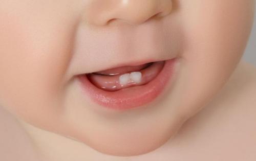 儿童伤牙习惯的矫正方法