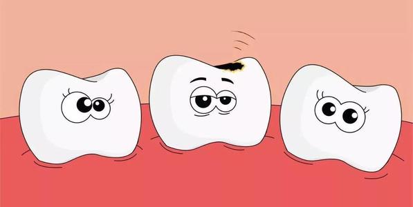 预防乳牙龋坏，这五步要做到位