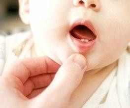 婴幼儿长牙期牙齿护理 重亲牙科医院