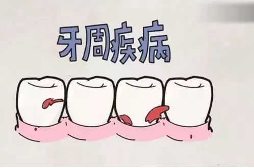 牙周病自检