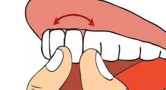 牙齿松动不用管？它的危害你知道吗？