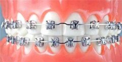 科普人到中年我们应该注意哪些牙齿问题?