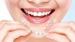专家讲解：为什么牙齿矫正成本的差异如此之大